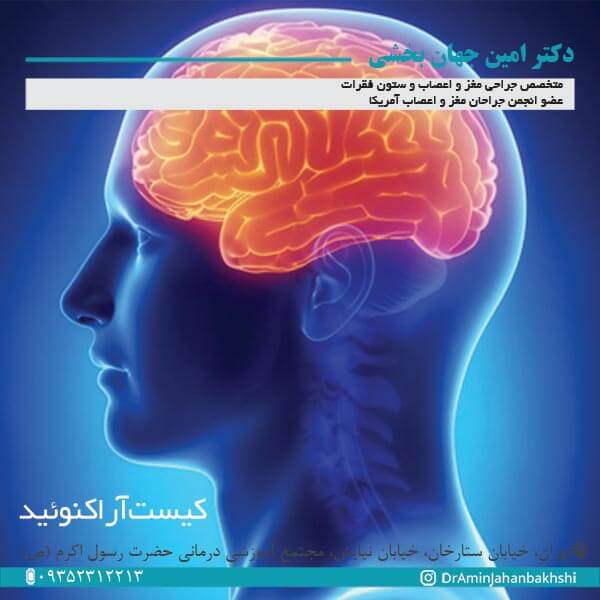کیست آراکنوئید - دکتر جهانبخشی