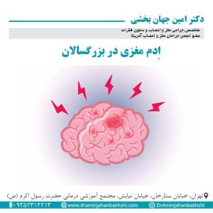اِدم مغزی در بزرگسالان