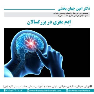 اِدم مغزی در بزرگسالان