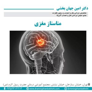 متاستاز مغزی - دکتر جهانبخشی
