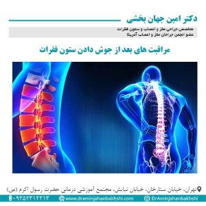 مراقبت های بعد از جوش دادن ستون فقرات