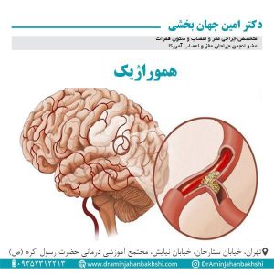 هموراژیک - دکتر جهانبخشی