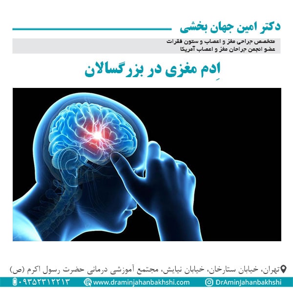 اِدم مغزی در بزرگسالان