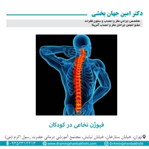 فیوژن نخاعی در کودکان
