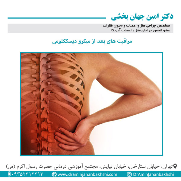 مراقبت های بعد از میکرو دیسککتومی