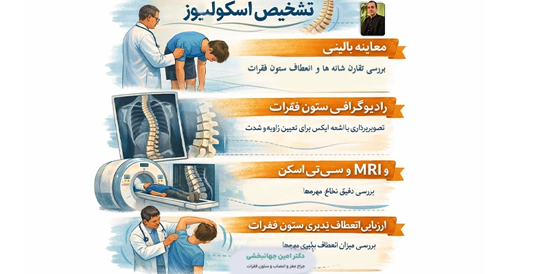 تشخیص اسکولیوز