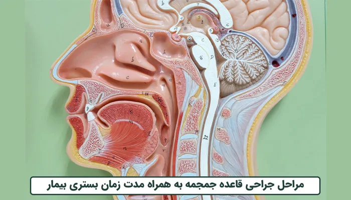 مراحل عمل قاعده جمجمه چیست؟