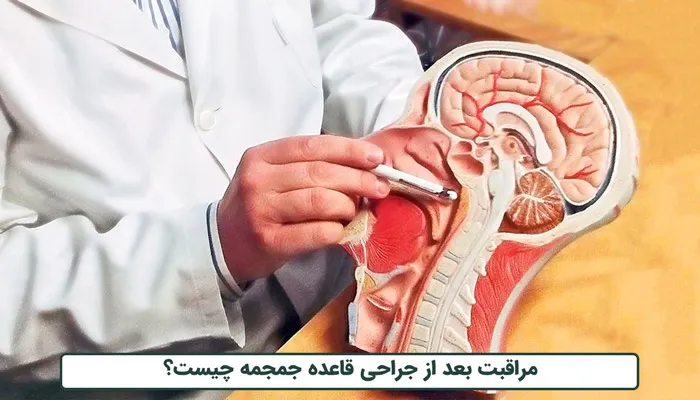 چگونه از بیماری که به تازگی عمل قاعده جمجمه انجام داده است مراقبت کنیم؟