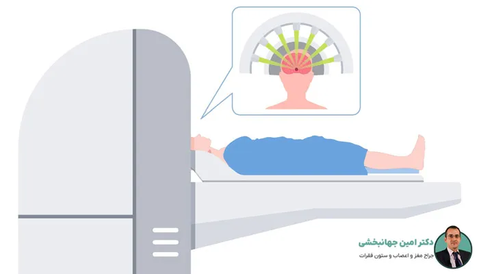 رادیوسرجری چیست؟