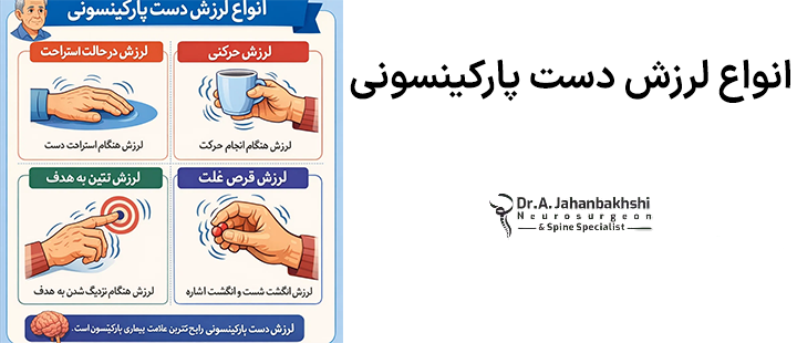 انواع لرزش دست پارکینسونی