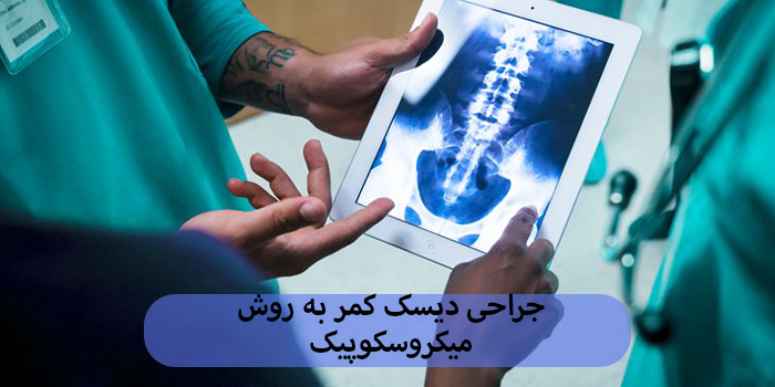 جراحی دیسک کمر به روش میکروسکوپیک