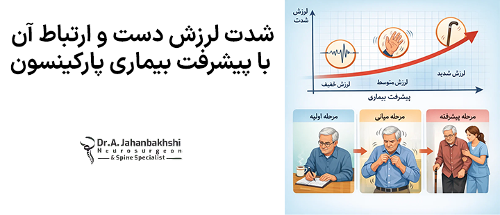 شدت لرزش دست و ارتباط آن با پیشرفت بیماری پارکینسون