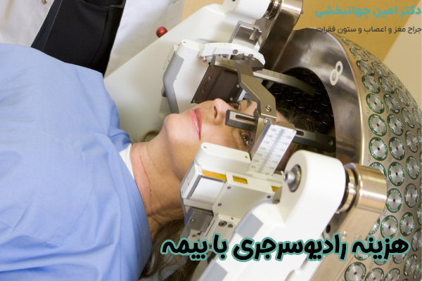 هزینه رادیوسرجری با بیمه