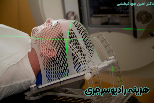 قیمت رادیوسرجری