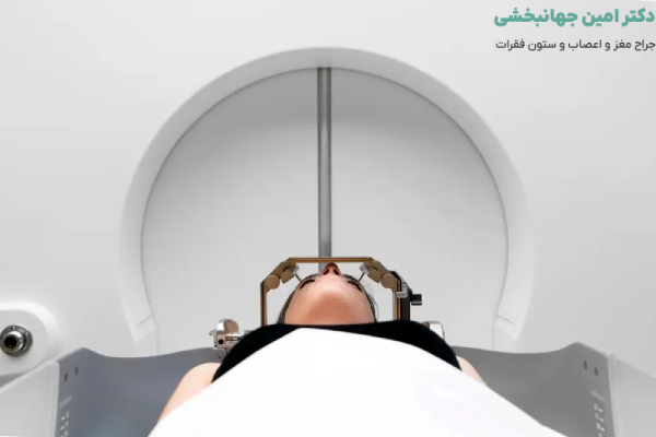 عوارض رادیوسرجری چیست