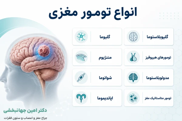 انواع تومور مغزی