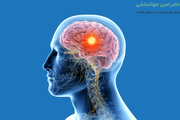 تومور مغزی چیست