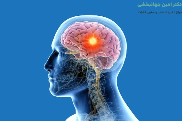 علائم تومور مغزی چیست